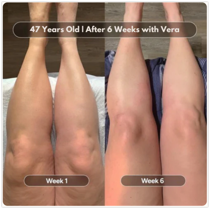 Yumora™ Anti Cellulite Massage Oil