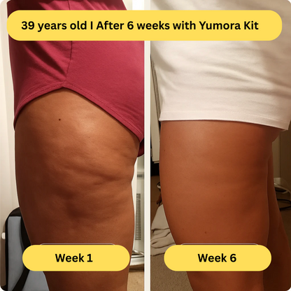 Yumora™ Anti Cellulite Massage Kit